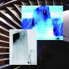 Thermal Inspection of Turbine Blades